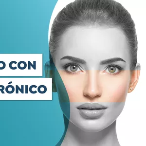 Imagen de portada para Curso online Tercio Medio con Ácido Hialurónico (Arco cigomático y surcos nasogenianos)