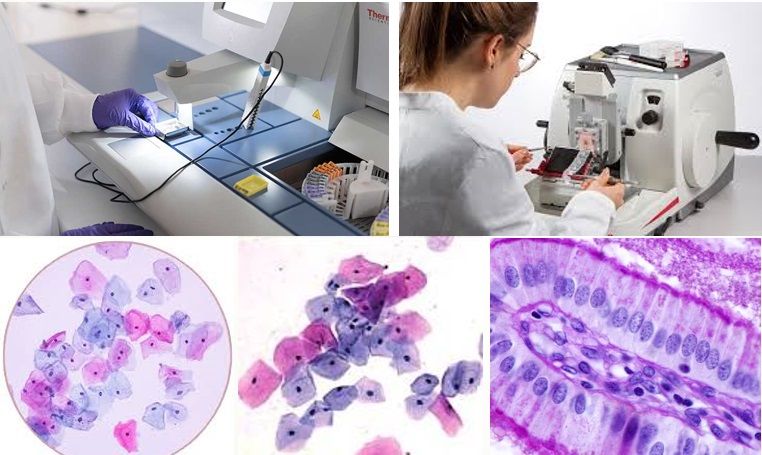 Imagem do curso Curso Extensão em Citologia Clínica e Patológica para Profissionais da Saúde