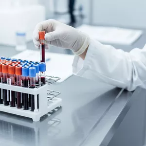 Imagem do curso Interpretação de Exames Bioquímicos