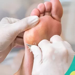 Imagem do curso APOSTILA curso Plástica dos pés