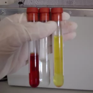 Imagem de capa para o Curso online Citologia de Líquido Cefalorraquidiano