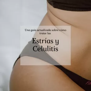 Imagen de portada para Ebook Una guía actualizada sobre cómo tratar las Estrías y Celulitis