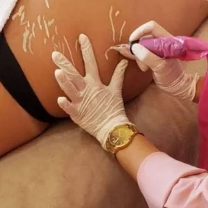 Cover image for Online course Stretch mark camouflage course