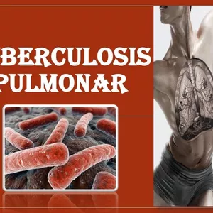 Imagen de portada para Ebook FÁRMACOS-PDF (Tuberculosis Pulmonar) Enfermeria-2024