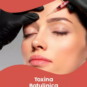 Toxina Botulínica Tipo A - Aplicação do básico ao avançado