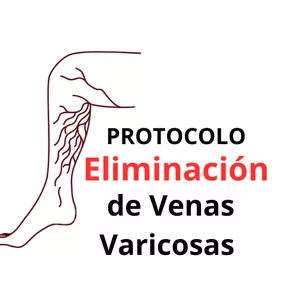 Imagen de portada para Ebook Protocolo Eliminación de Venas Varicosas