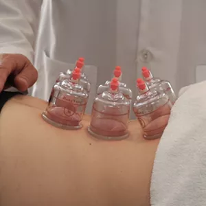 Imagem de capa para o Curso online Curso Ventosaterapia Aplicada