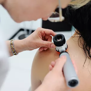 Imagem de capa para o Curso online Pós-Graduação em Dermatologia 