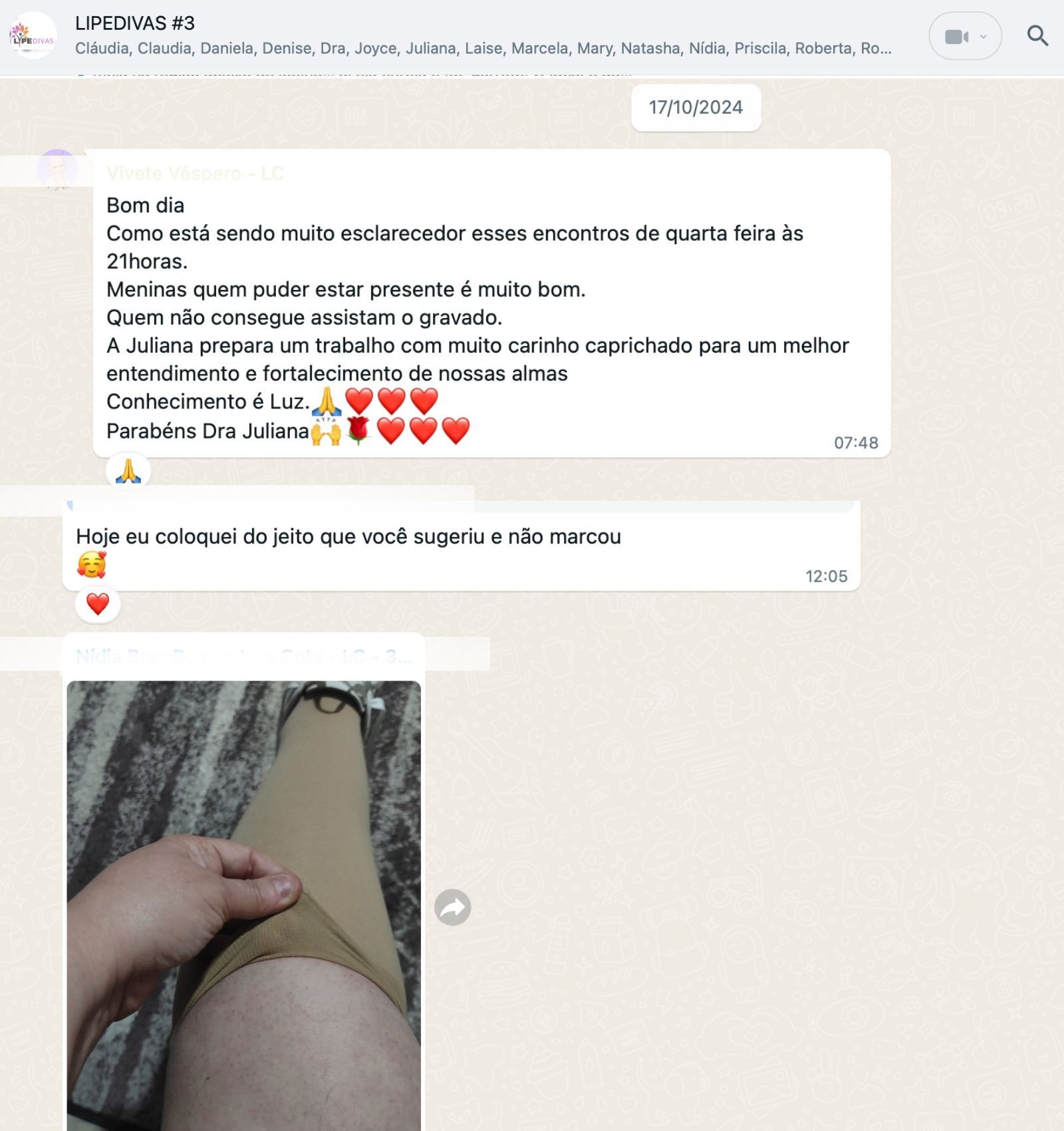 tratamento lipedema opinião