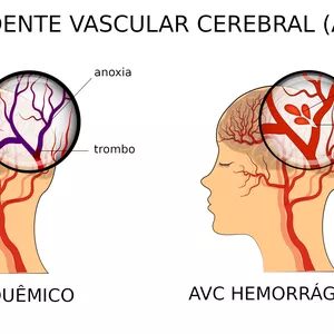 Imagem de capa para o Ebook AVE