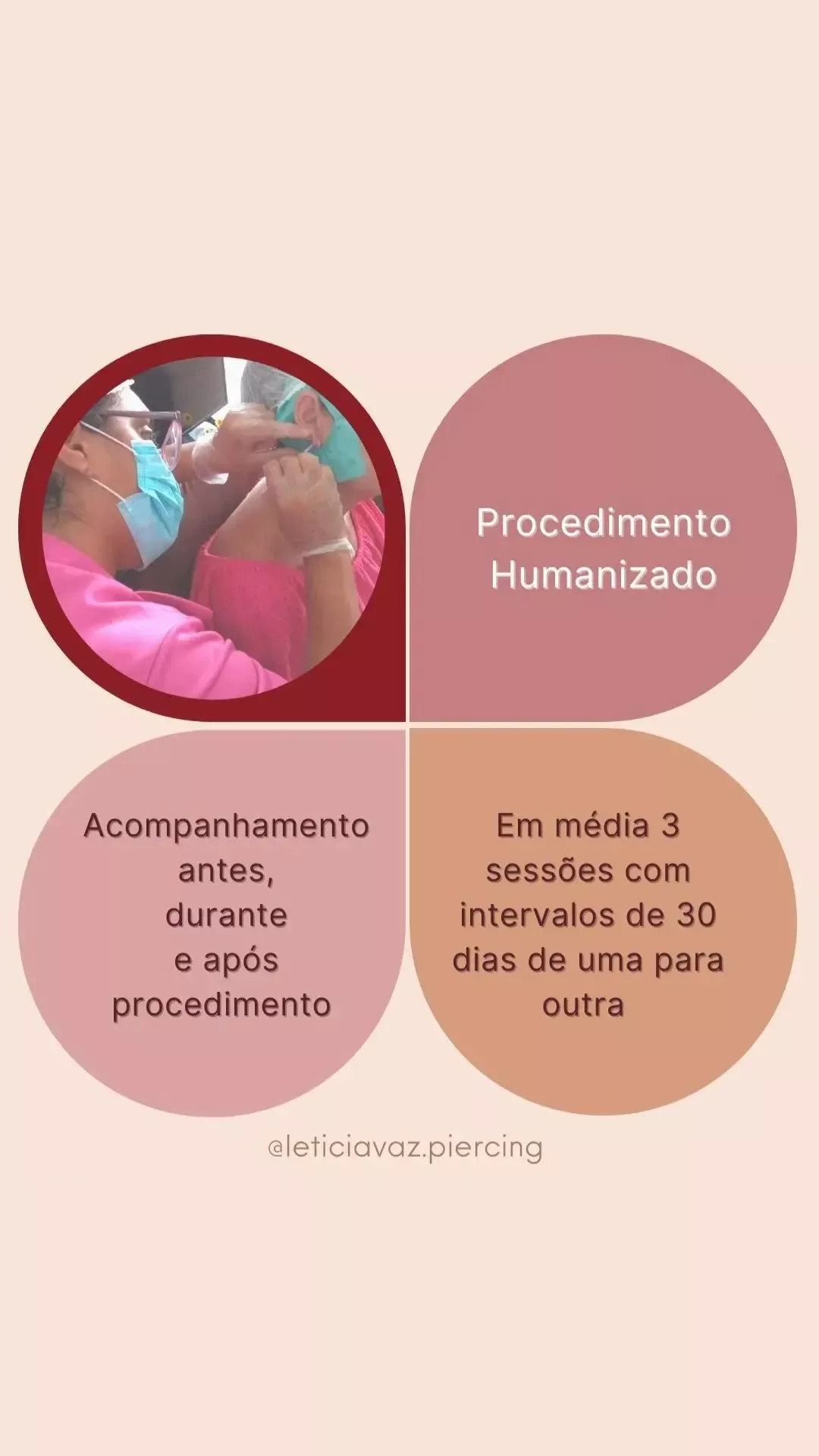 Curso de Lobuloplastia - Guia Completo para uma Reconstrução de Orelhas Rasgadas" — imagem 6