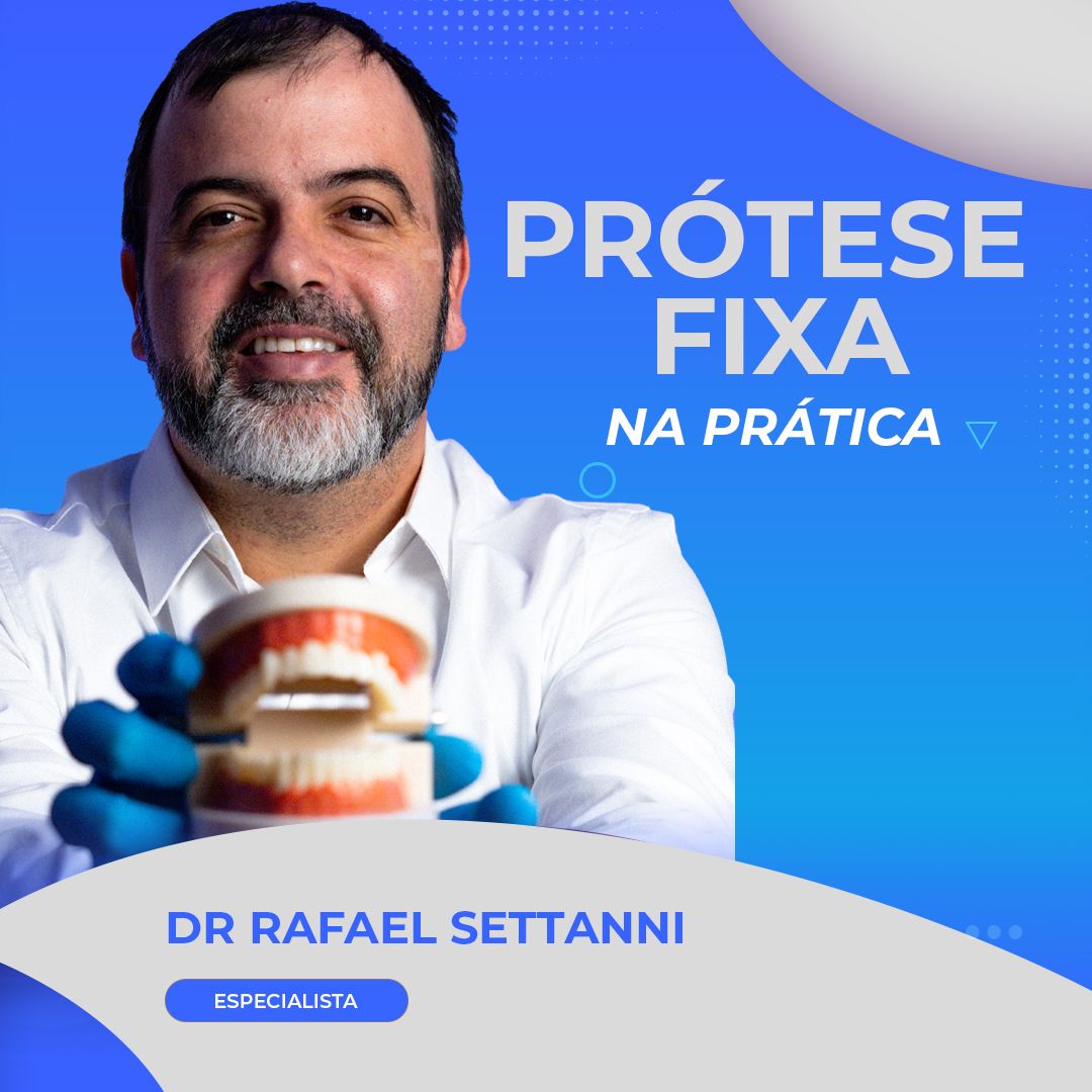 Imagem do curso Prótese Fixa na Prática