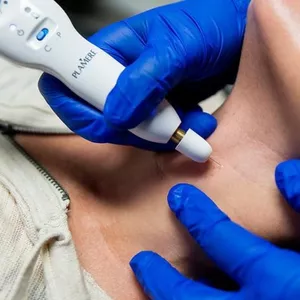 Imagen de portada para Curso online Fibroblast pen