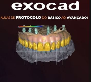 Imagem do curso Curso de Exocad do Basico ao Avançado + brinde