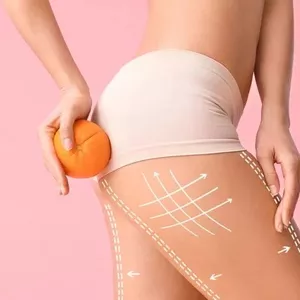 Imagen de portada para Ebook Recetas para acabar con la Celulitis em 30 Días