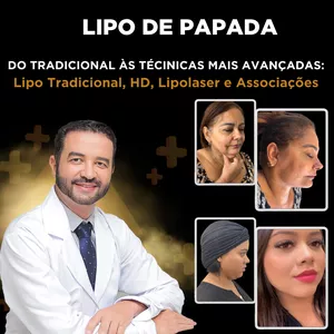 Imagem de capa para o Curso online Lipo de Papada Tradicional, HD, Lipolaser e Associações