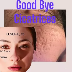 Imagen de portada para Ebook GOOD BYE CICATRICES 