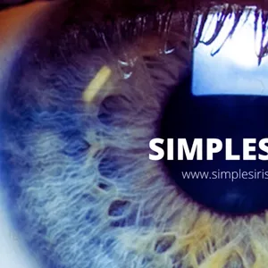 Imagem de capa para o Curso online Simples Íris – Sistema Completo de Análise de Íris