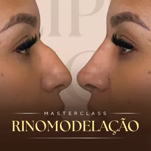 Imagem de capa para o Curso online MasterClass de Rinomodelação - Dra Luiza Mol
