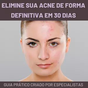 Imagem de capa para o Ebook Acne Zero: Elimine sua acne de forma definitiva em 30 dias com o Método Berret