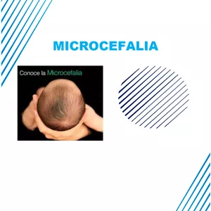 Imagen de portada para Ebook MICROCEFALIA EGRAFIA 