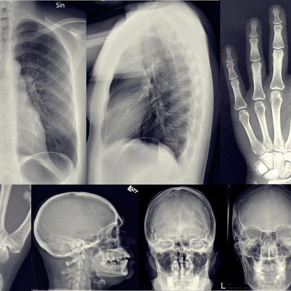 Anatomia Radiografica Cerd Centro De Ensino Radiologico A Distancia Learn A New Skill Online Courses And Subscription Services Hotmart