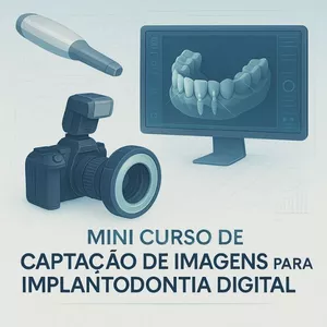 Imagem de capa para o Curso online André Soratto | Mini Curso de Captação de Imagens para Implantodontia Digital