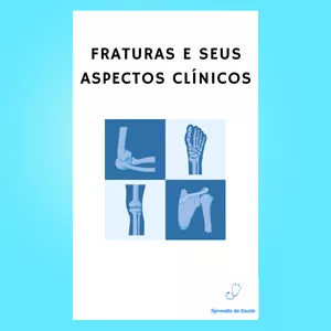 Imagem de capa para o Ebook Fraturas e seus aspectos clínicos 