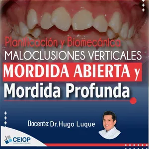Imagen de portada para Curso online Planificación y Biomecánica Maloclusiones Verticales MORDIDA ABIERTA Y MORDIDA PROFUNDA 