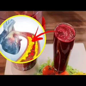 Imagen de portada para Curso online PROGRAMA DE REDUCCIÓN DE CLESTEROL 0.1