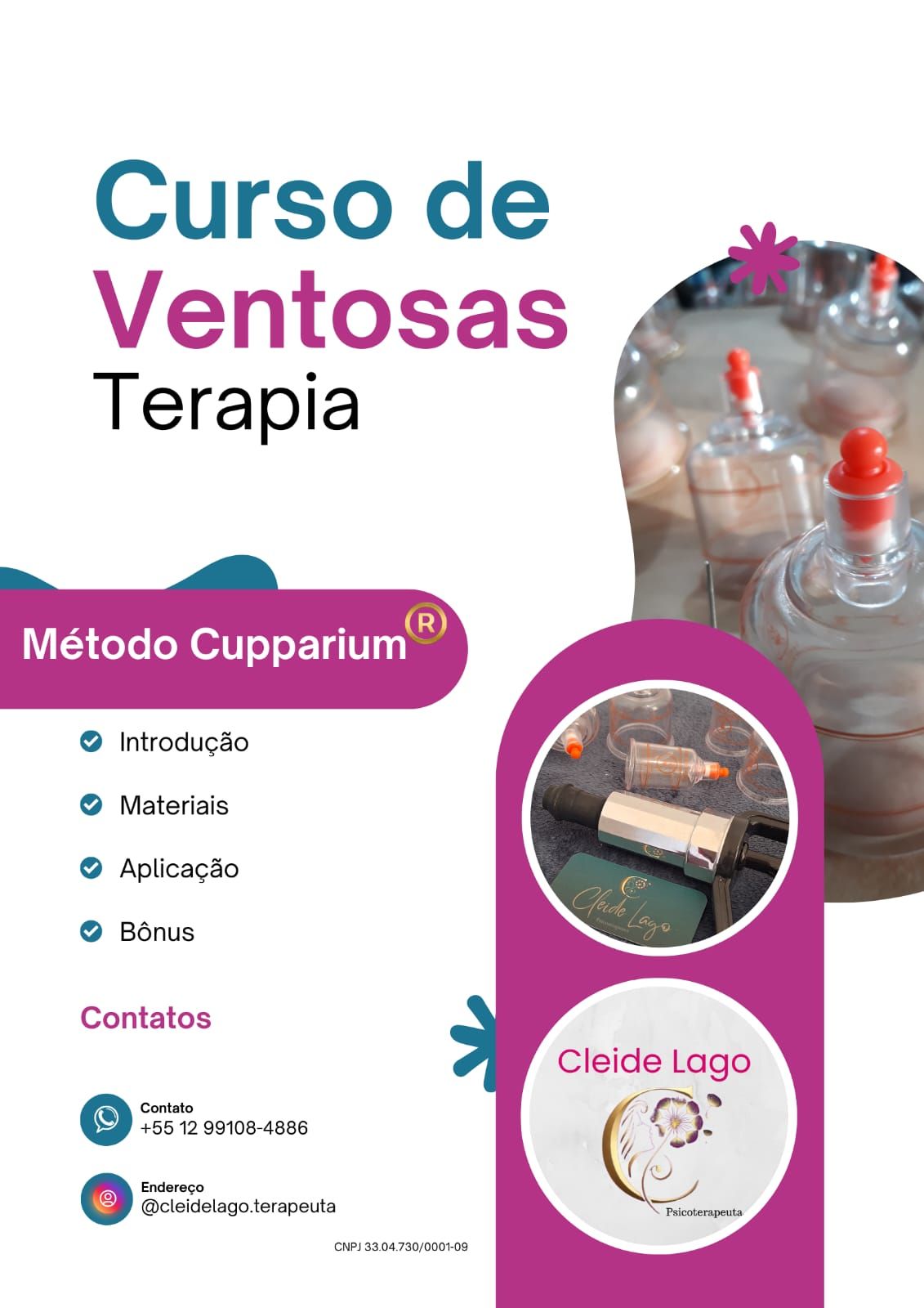 Imagem do curso CURSO DE VENTOSATERAPIA - Método Cupparium