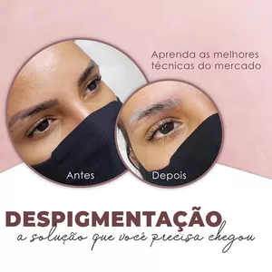 Imagem do curso Despigmentação Quimica