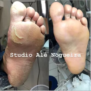 Imagem de capa para o Curso online Cosmetologia na Podologia - Alê Nogueira 