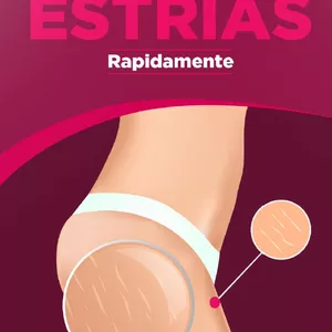 Imagem de capa para o Ebook Como Eliminar Estrias Rapidamente