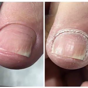 Imagem de capa para o Curso online Cutilagem de alto padrão 