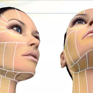 Imagen de portada para Curso online HIFU