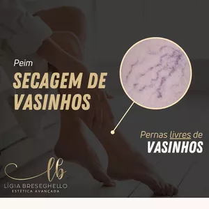 Imagem do curso Peim- secagem de vasinhos 