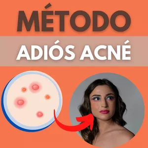 Imagen de portada para Curso online  Método Adiós Acné 