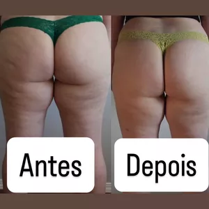 Imagem de capa para o Ebook Adeus Celulite