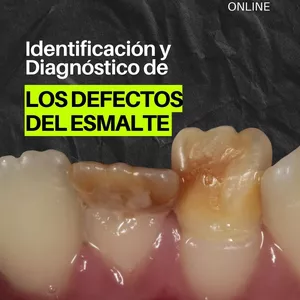 Imagen de portada para Curso online Identificación y Diagnóstico de Los Defectos del Esmalte