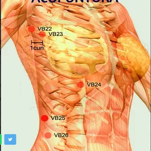 Cover image for Ebook Acupunture Manual 