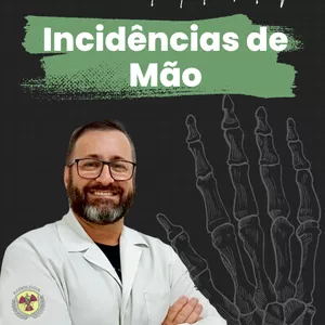 Imagem de capa para o Ebook Incidências de Mão e Quirodactilos