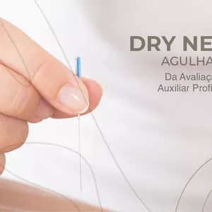 Imagem de capa para o Ebook Curso Completo de Dry Needling: Técnicas Avançadas para o Alívio da Dor