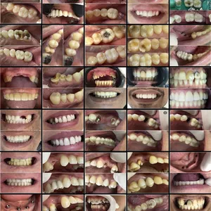 Imagem de capa para o Ebook FOTOS DE ANTES x DEPOIS DENTISTA 