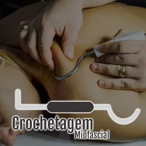 Imagem do curso Curso de Crochetagem Miofascial - Online (EAD)