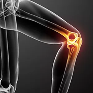 Imagem de capa para o Ebook Como Acabar com as Dores nos Joelhos: Guia Completo Premium para Prevenção e Tratamento