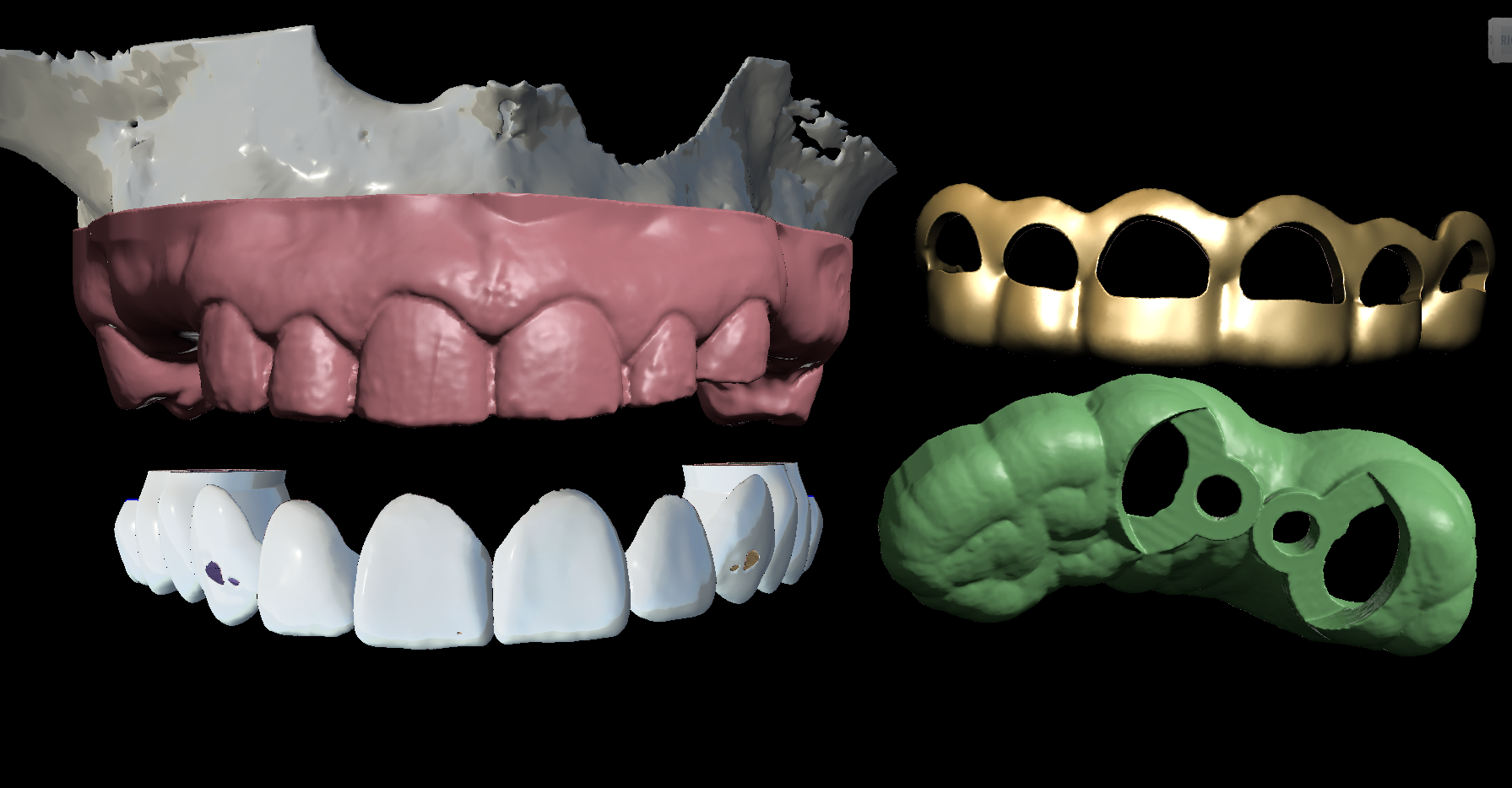 Imagem do curso Curso Odontologia Digital - Formação Planner