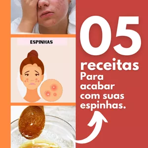 Imagem de capa para o Curso online 5 receitas para acabar com as suas espinhas
