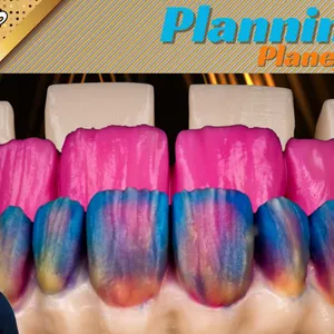 Curso Curso Protocolo Cerâmico