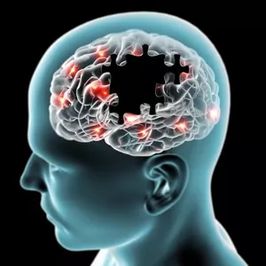 Imagem de capa para o Ebook CUIDADORES DE IDOSOS CONHECENDO A DOENÇA DE PARKINSON